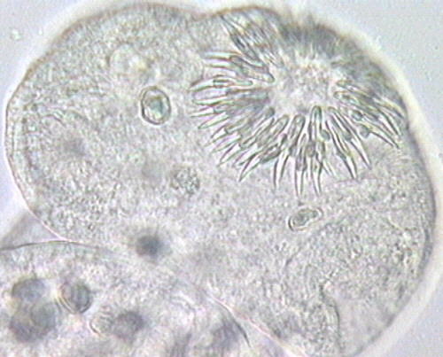 Zdjęcia - echinococcusgranulosus4.jpg