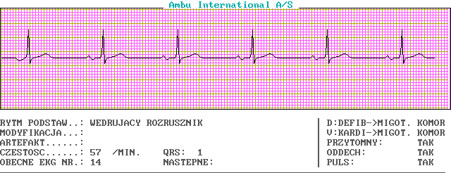 Wykresy EKG - c14-0.png