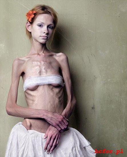 Anoreksja i bulimia - 3.jpg